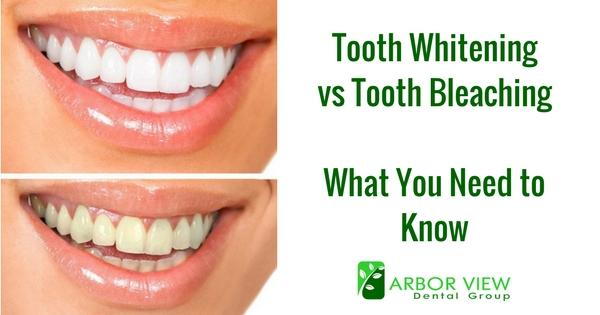 Tooth Whitening vs Tooth Bleaching